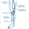 Varicose Veins Operation.indd | Dr Matley & Partners